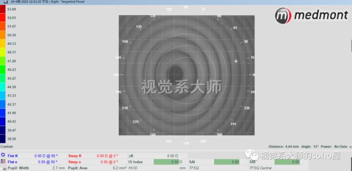 ok镜一周不戴近视更厉害吗,戴了ok镜真的可以恢复视力吗