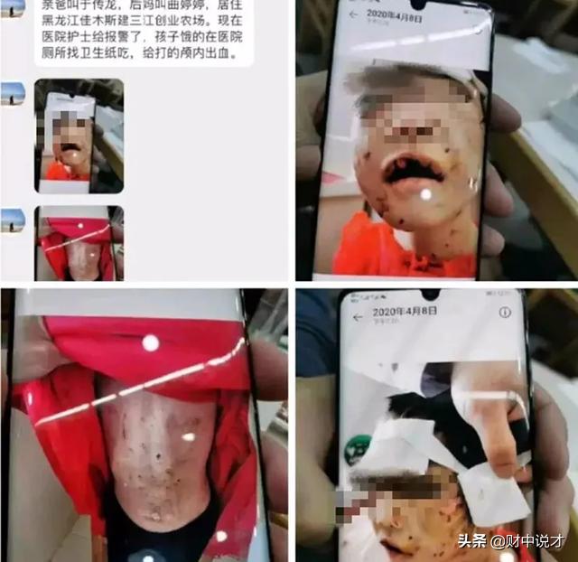 被打进icu的女童,三岁孩童被打进icu