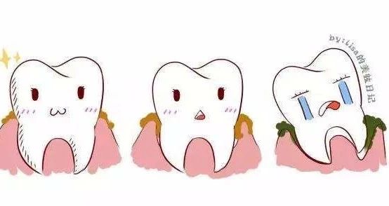 猫猫口炎是什么导致的,猫猫口炎反反复复怎么办