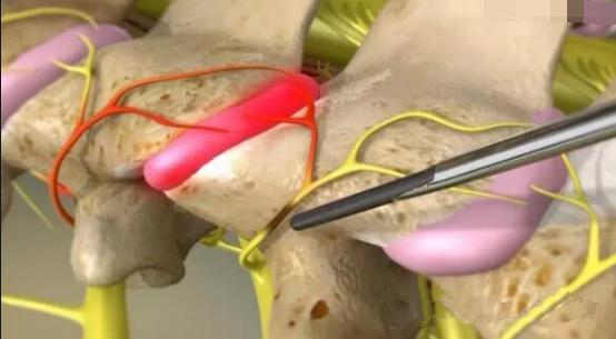 运动耳鸣眼花头晕怎么回事,头晕耳鸣眼花怎么锻炼