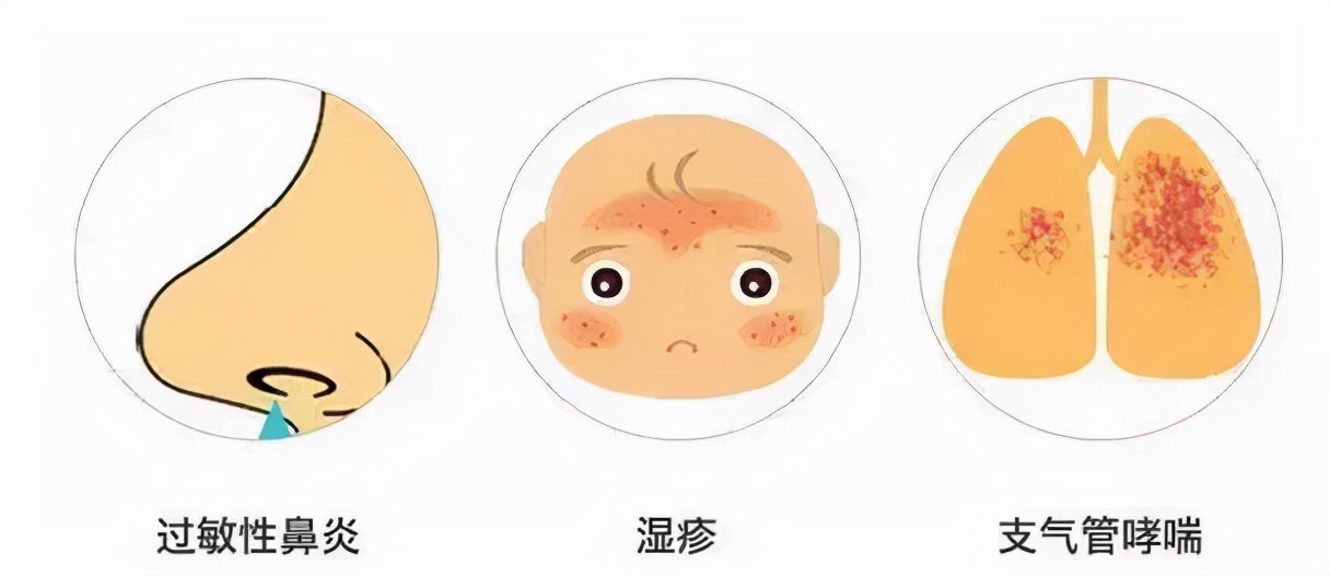 珀婷pertine除螨仪,珀婷PERTINE深度除螨喷雾剂