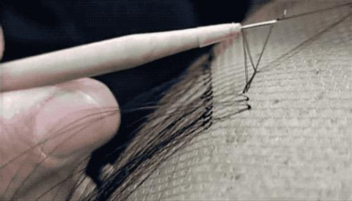 突如其来是什么原因引起的,突如其来的脱发