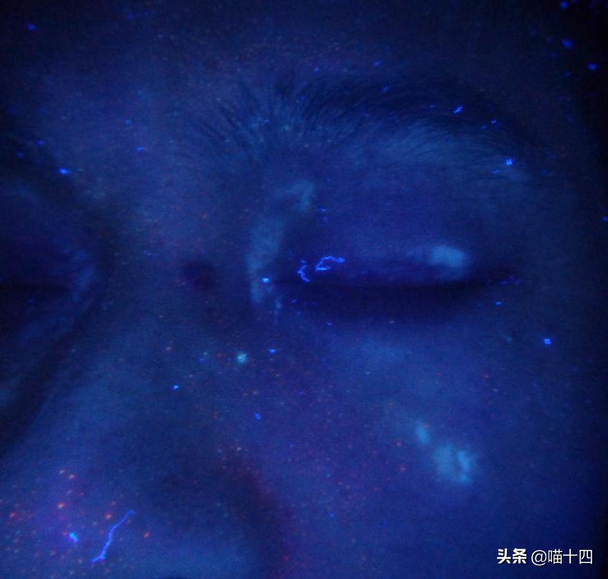 宠物荧光伍德氏灯,猫癣专用伍德氏灯