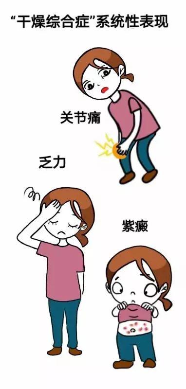 得了干燥综合症怎样用药,干燥综合征注意事项