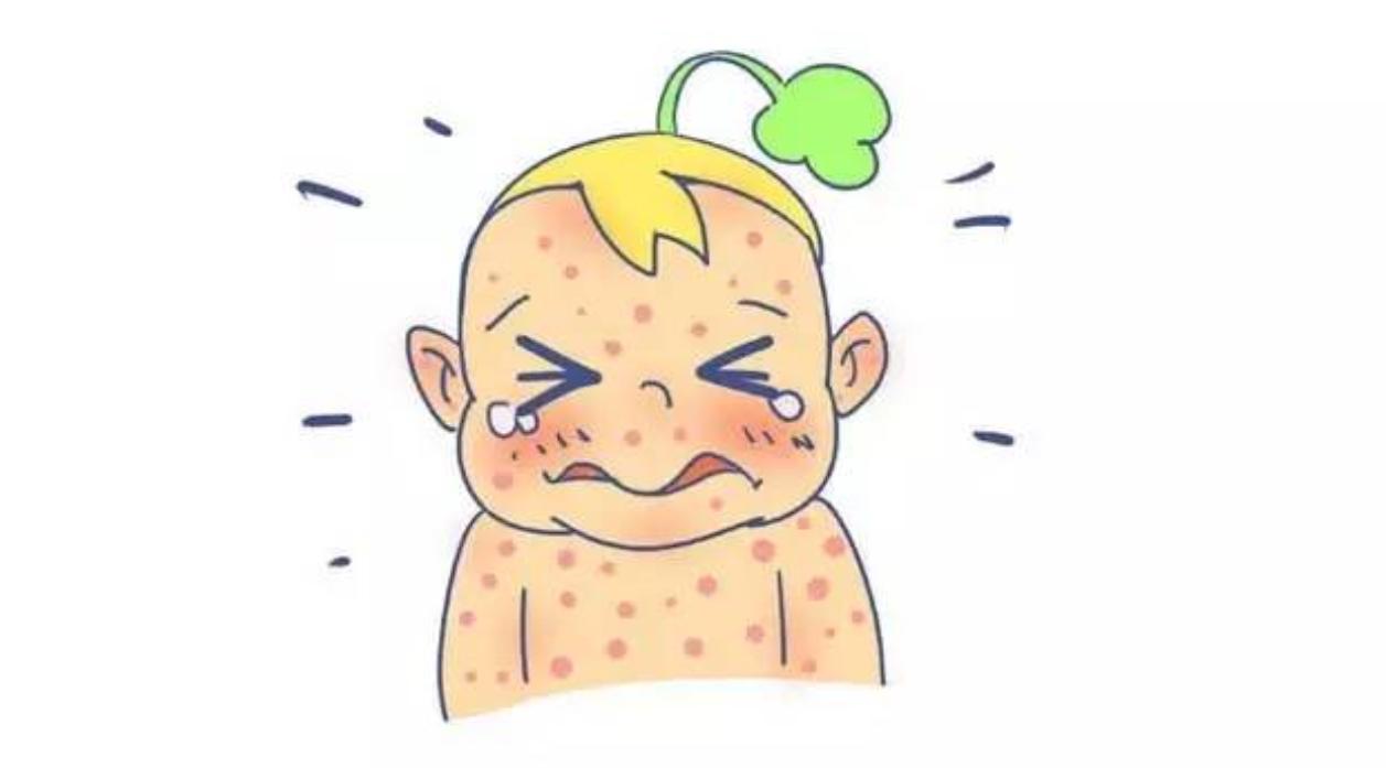 宝宝背后有疹子是什么疹子,宝宝出疹子会有什么疹子