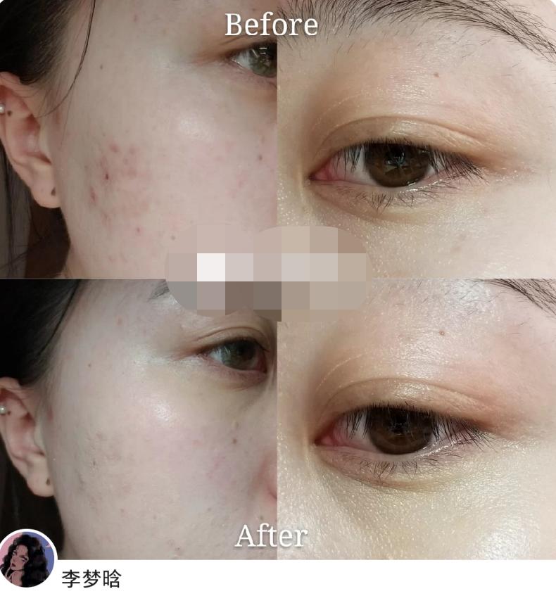 比较滋润好用的遮瑕推荐,平价遮瑕哪款好用啊