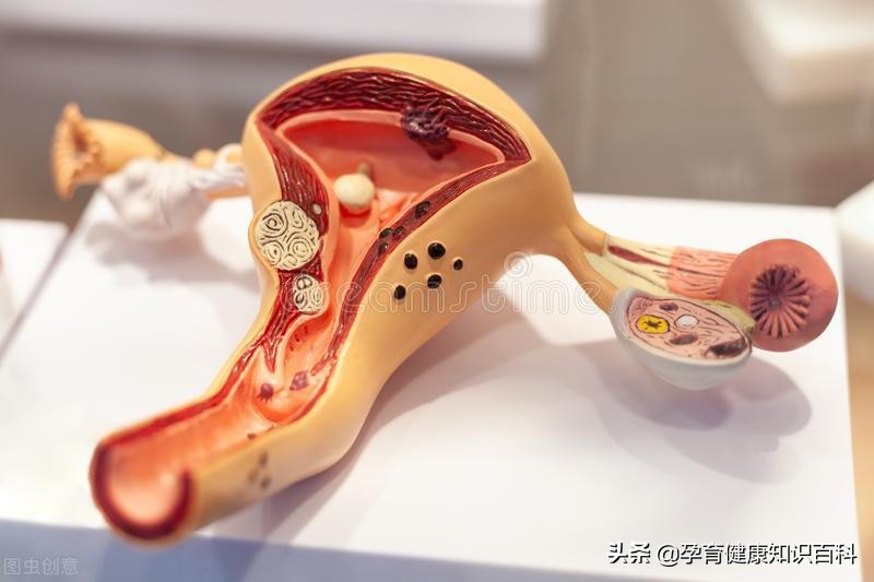 子宫畸形能不能生育,子宫畸形什么原因造成的