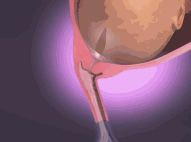 包裹胎儿的水为什么叫羊水,为什么胎水叫羊水