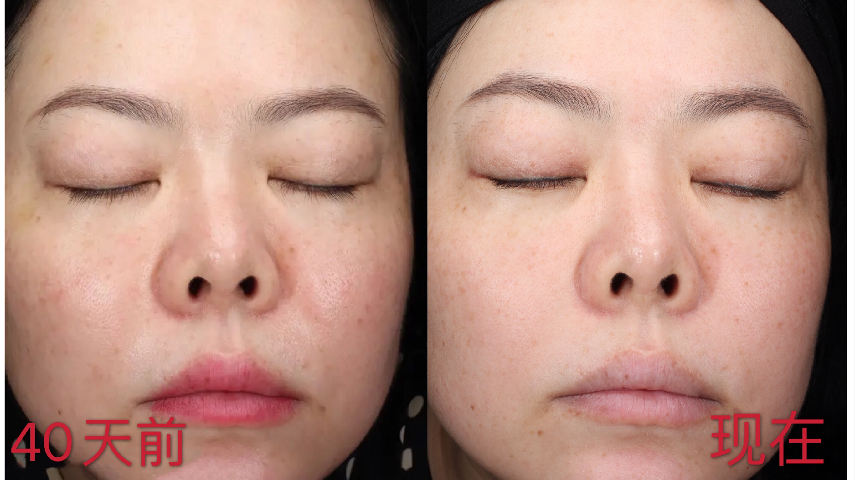 玉兰油小滴管和小白瓶哪款好用,sk2小灯泡好还是玉兰油小白瓶好