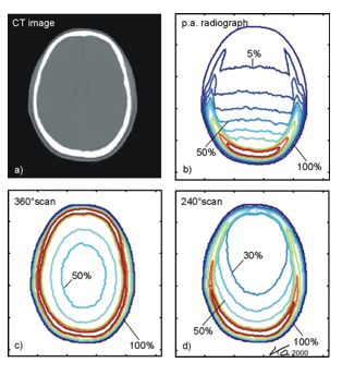 ct图像解析大全,ct图像与实物大小对比