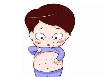 宝宝麻疹最佳治疗方法,预防麻疹流行最有效可行的措施