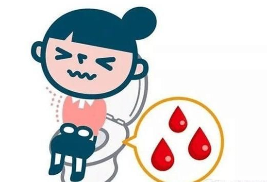 怎样判断得了产后痔疮,怎么判断自己得了肛瘘还是痔疮