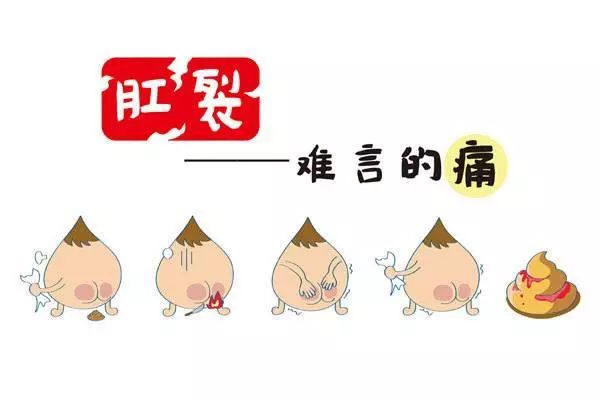 肛裂疼不疼,肛裂疼痛难忍必须手术吗