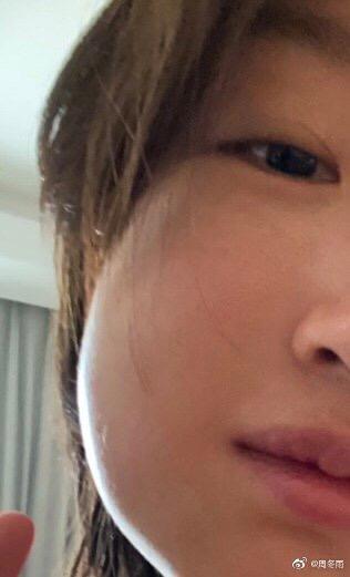 智齿到底要不要拔医生告诉你答案,智齿必须拔掉的五种情况