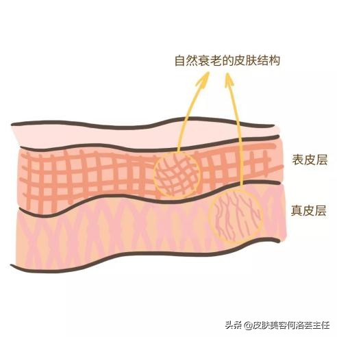 脸上出现皱纹，我老了？5个皱纹产生的原因，别再视而不见