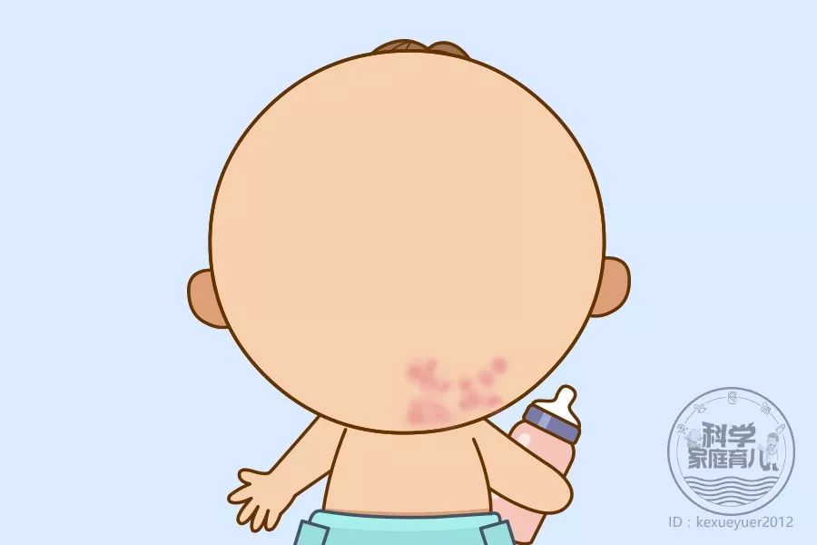 胎记很多痣密密麻麻,胎记是颗凸起的痣要去掉吗