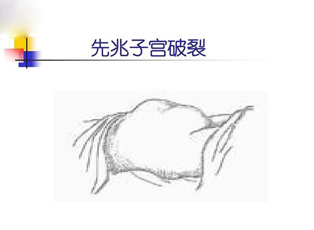 孕期为啥总是肚子痛？一般情况无需紧张，但有这样的现象就要重视