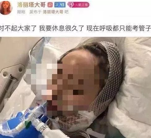 女主播洛丽塔大哥整容意外成整形医生反面教材:要安全变美