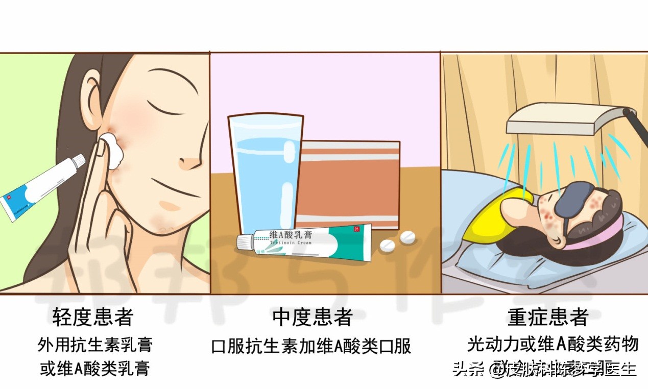 用碘伏治痘痘怎么正确使用,用碘伏擦痘痘可以消除吗