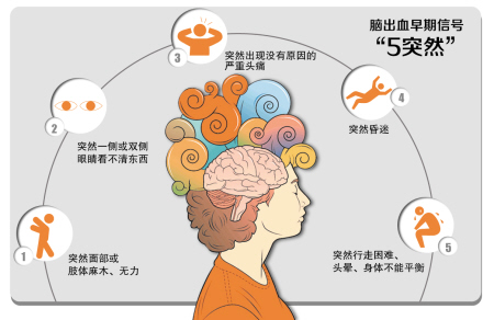 脑干出血没有生命体征能引流吗,预防脑干出血最佳方法