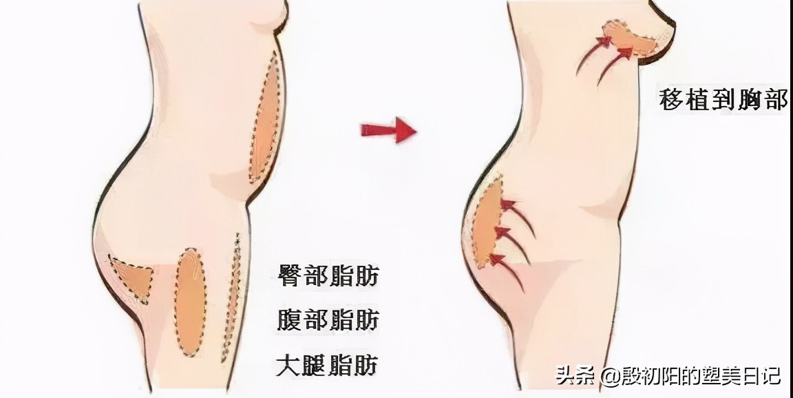 变废为宝,变肥为宝t恤