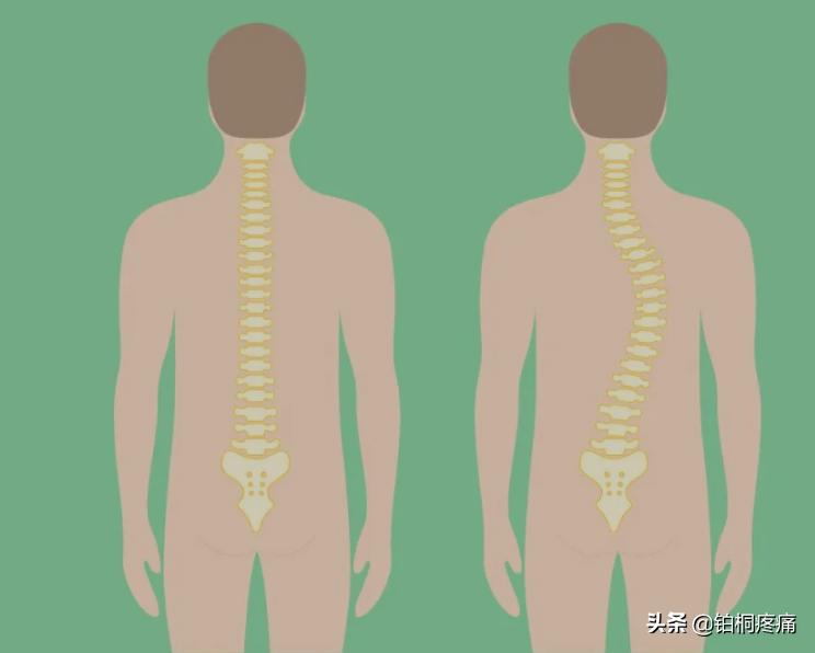 喜欢翘二郎腿怎样办,翘二郎腿你是怎么做到的