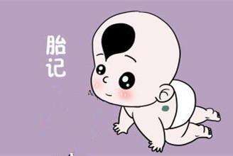 儿童胎记真的能消掉吗,孩子的胎记有危险吗