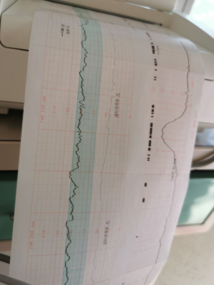 除夕夜在医院度过,鼠年到牛年,我走过的保胎之路