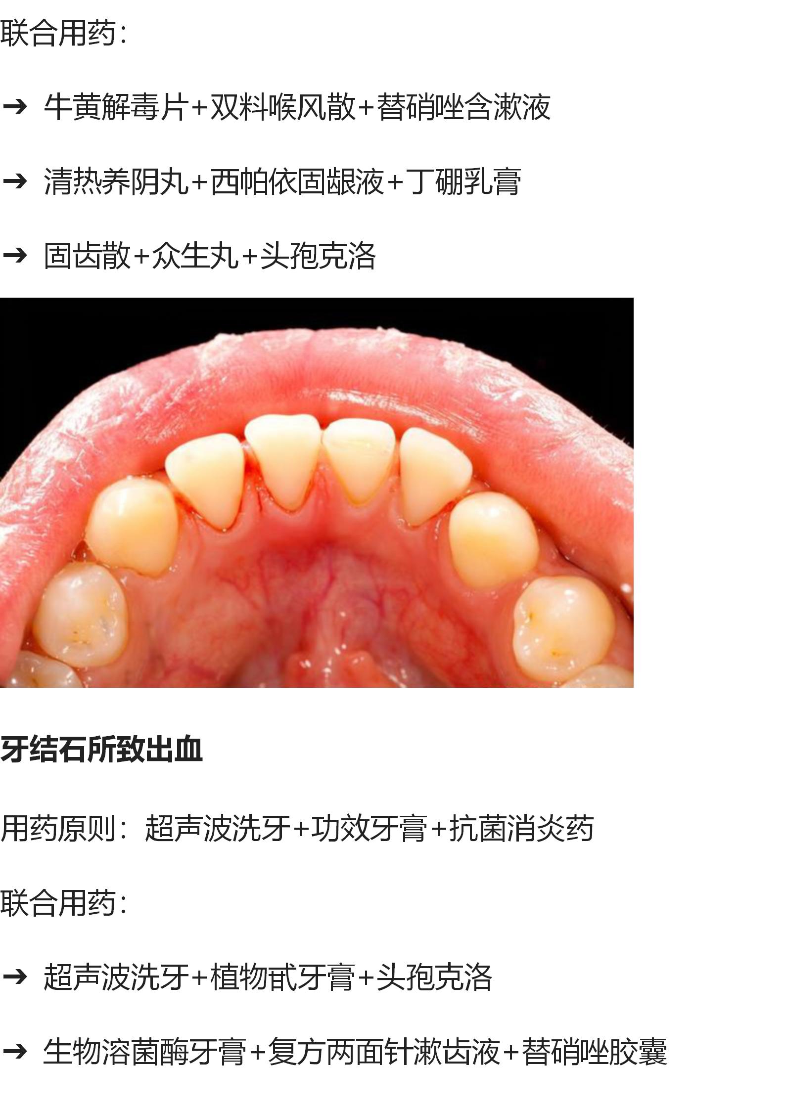 口腔牙龈最新治疗,口腔牙龈出血有什么好的方法