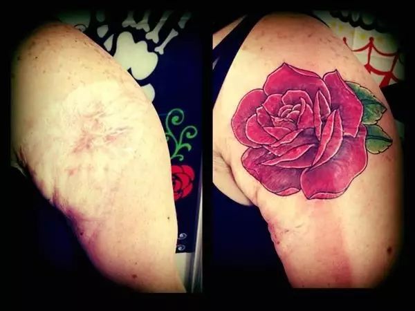 用纹身掩盖自己的伤疤,纹身是为了掩盖伤疤