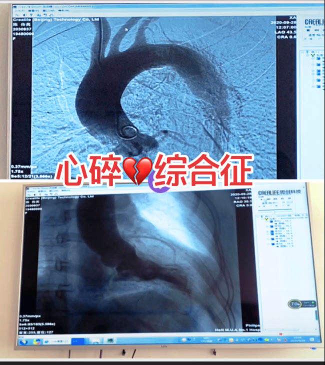 涓尰璋堜激蹇冨咖浼よ偤鎬濅激鑴炬亹浼よ偩,鍖诲鐢ㄨ琛ㄨ揪鎮蹭激杩囧害