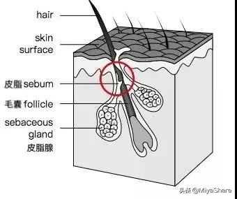 教你如何从根源解决黑头,反复黑头的原因和解决方法