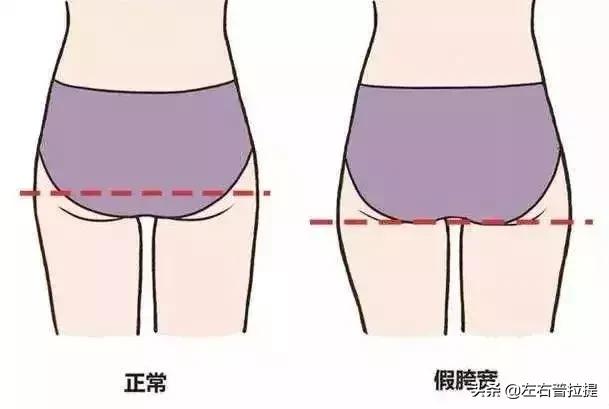 假胯宽普拉提怎样训练,假胯宽练普拉提注意事项