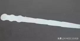 纤维桩的优点和缺点,看完这篇文章就明白了