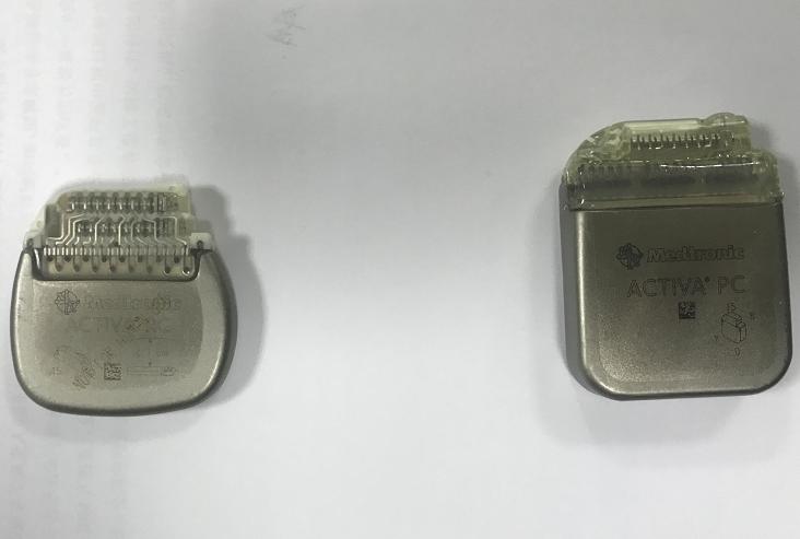 脑起搏器手术福州,南京脑起搏器治疗帕金森