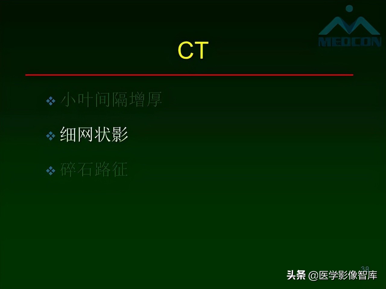 肺弥漫性网状影,两肺小叶间隔增厚可见网状模糊影
