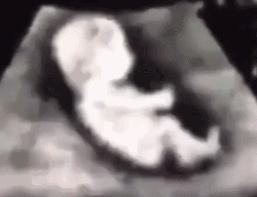 吃了减肥药物怀孕,吃了减肥药怀孕胎停