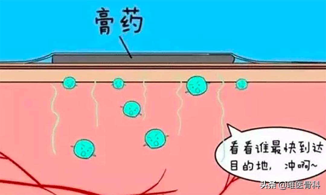 腰酸背痛就用万通筋骨贴,累的腰酸背痛贴膏药管用吗