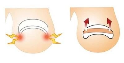 甲沟炎和糖尿病有关吗,糖尿病甲沟炎是糖尿病足吗