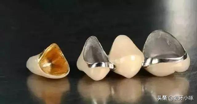 烤瓷牙和全瓷牙的区别哪种材料好,烤瓷牙和全瓷牙区别哪个更好