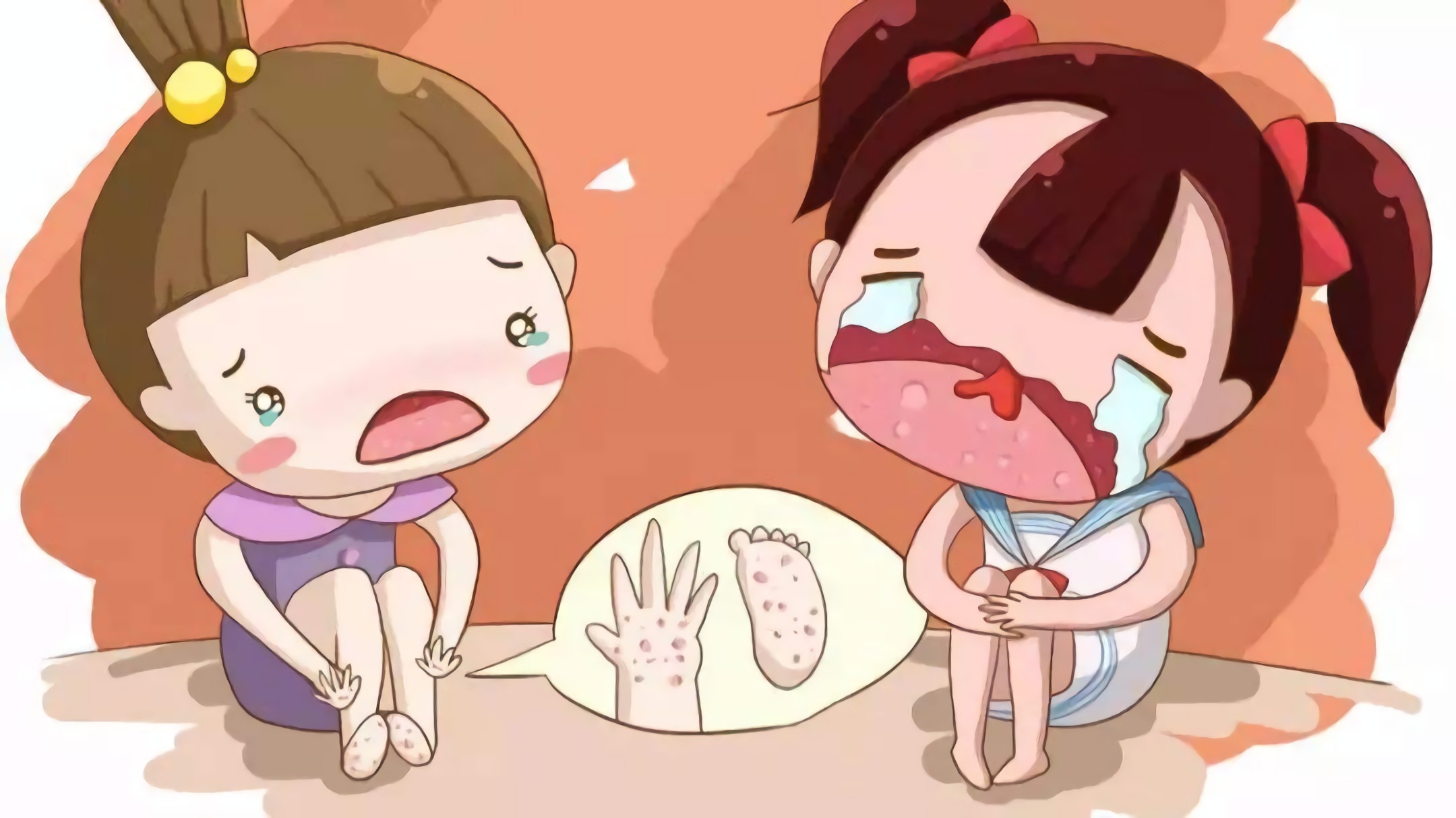 压力紫癜和过敏紫癜如何区分,肠胃性过敏紫癜是腹型过敏紫癜吗