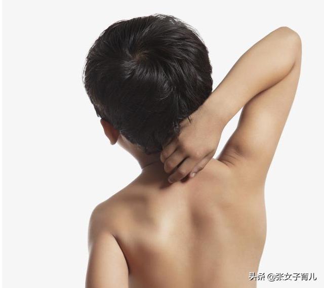 夏天宝宝长痱子有什么好办法吗,宝宝一到夏天就长痱子怎么办