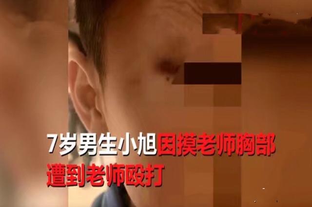 “我想跟她玩”，7岁男童摸女老师胸部被打，原因引人注目