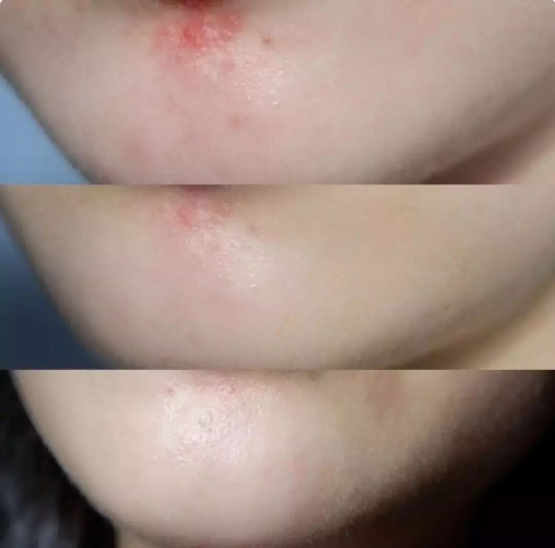 堪比科颜氏白泥的其他护肤品,堪比科颜氏精华