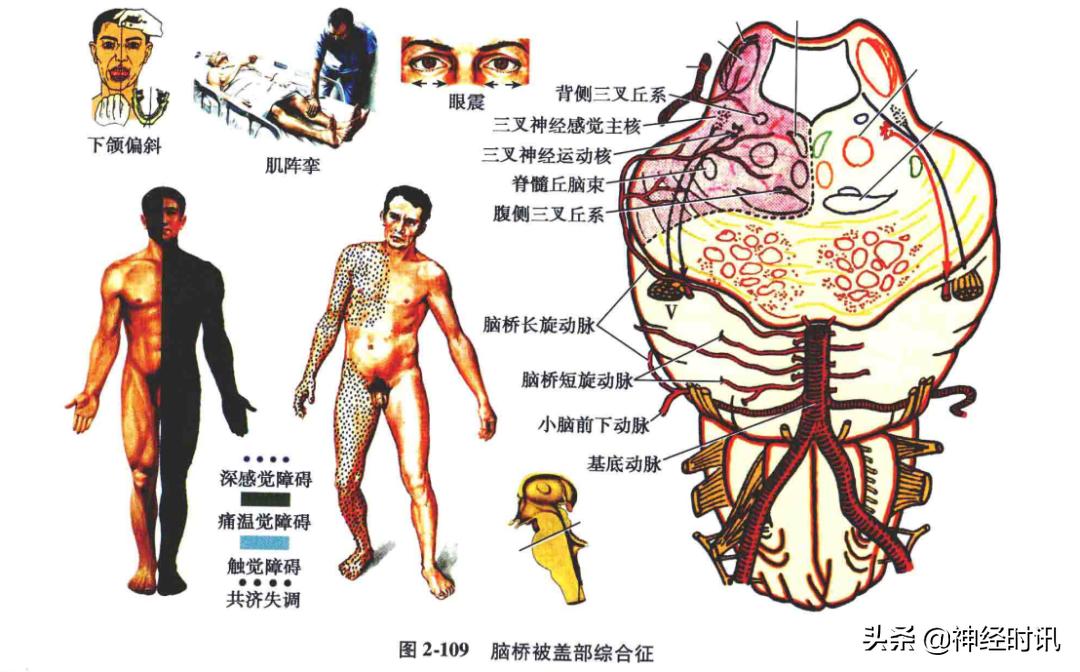 脑干解剖,脑干神经解剖