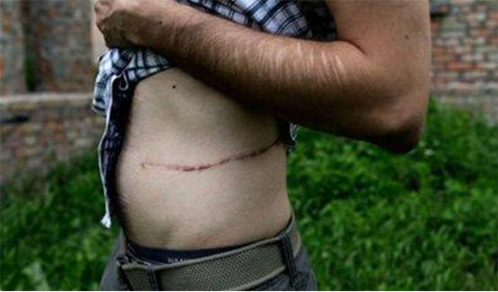 尼泊尔肾谷在哪里,尼泊尔靠肾发财是真的吗