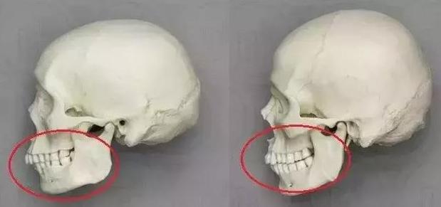 女人法令纹怎么护肤好得快,女生长法令纹怎么安慰