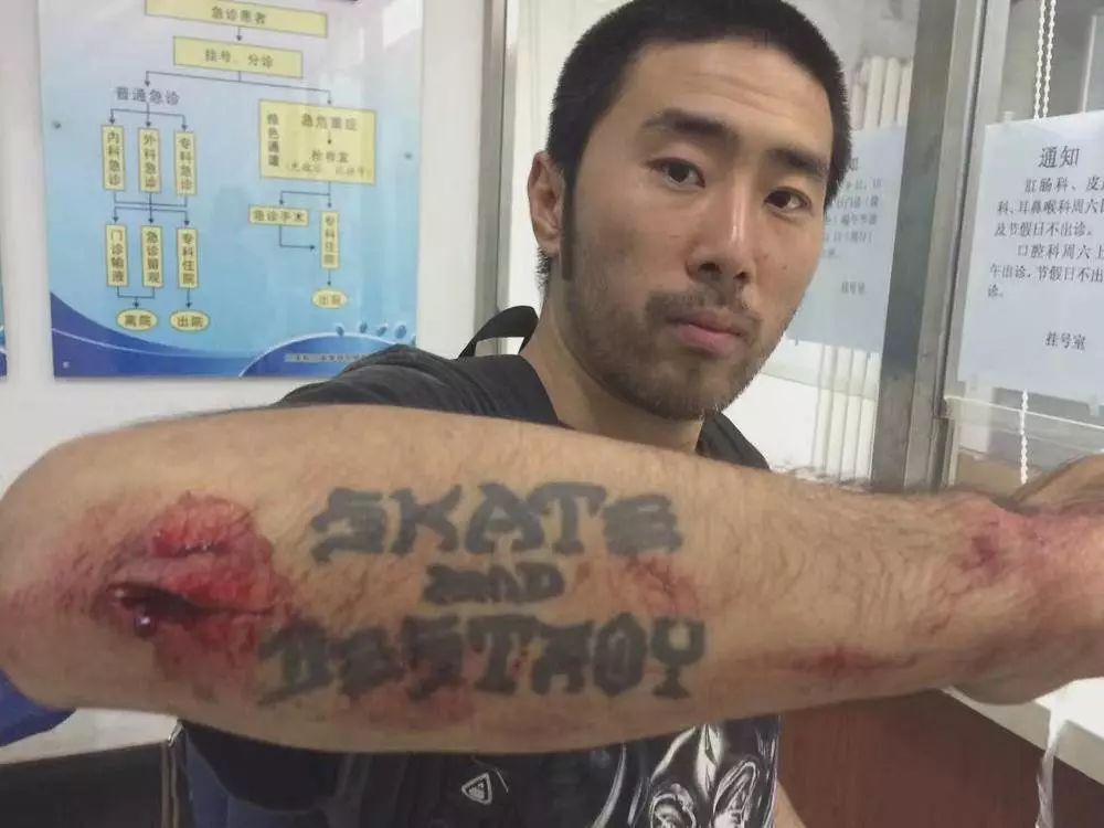 中国滑板女孩进奥运,滑板入选过几次奥运