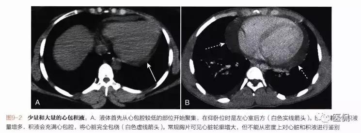 胸侧位正位片可以检查出什么,胸部正位侧片是测什么的