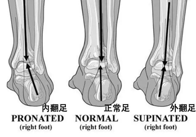缓震跑鞋是碳板跑鞋吗,缓震跑鞋有必要买吗